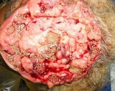 paraziták az emberi agyban