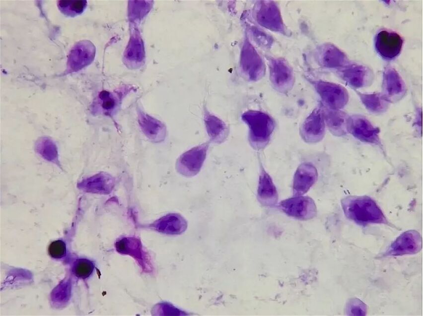 hogyan lehet megszabadulni az emberi lambliától